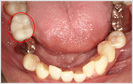 治療後症例写真