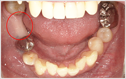 治療前症例写真