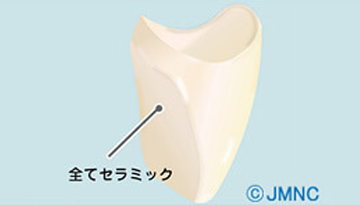 セラミッククラウン